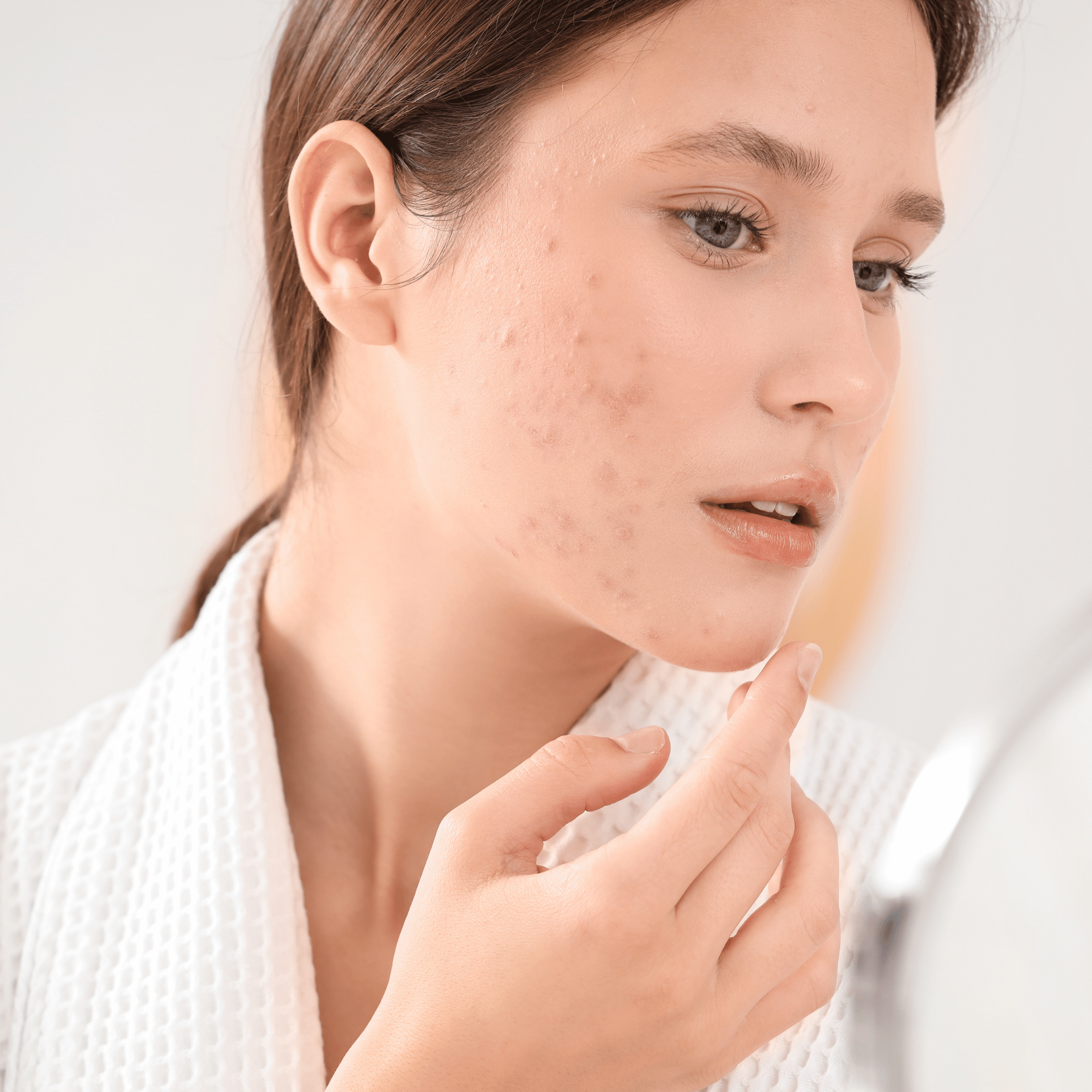 Skuteczna terapia cery problematycznej po 25. roku życia – przewodnik po profesjonalnej pielęgnacji